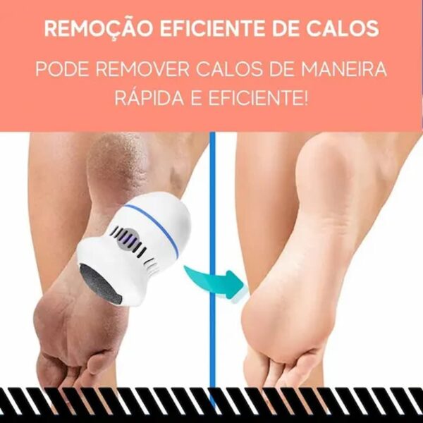 Lixa Elétrica para os Pés Portátil Removedor de Calos - Image 3